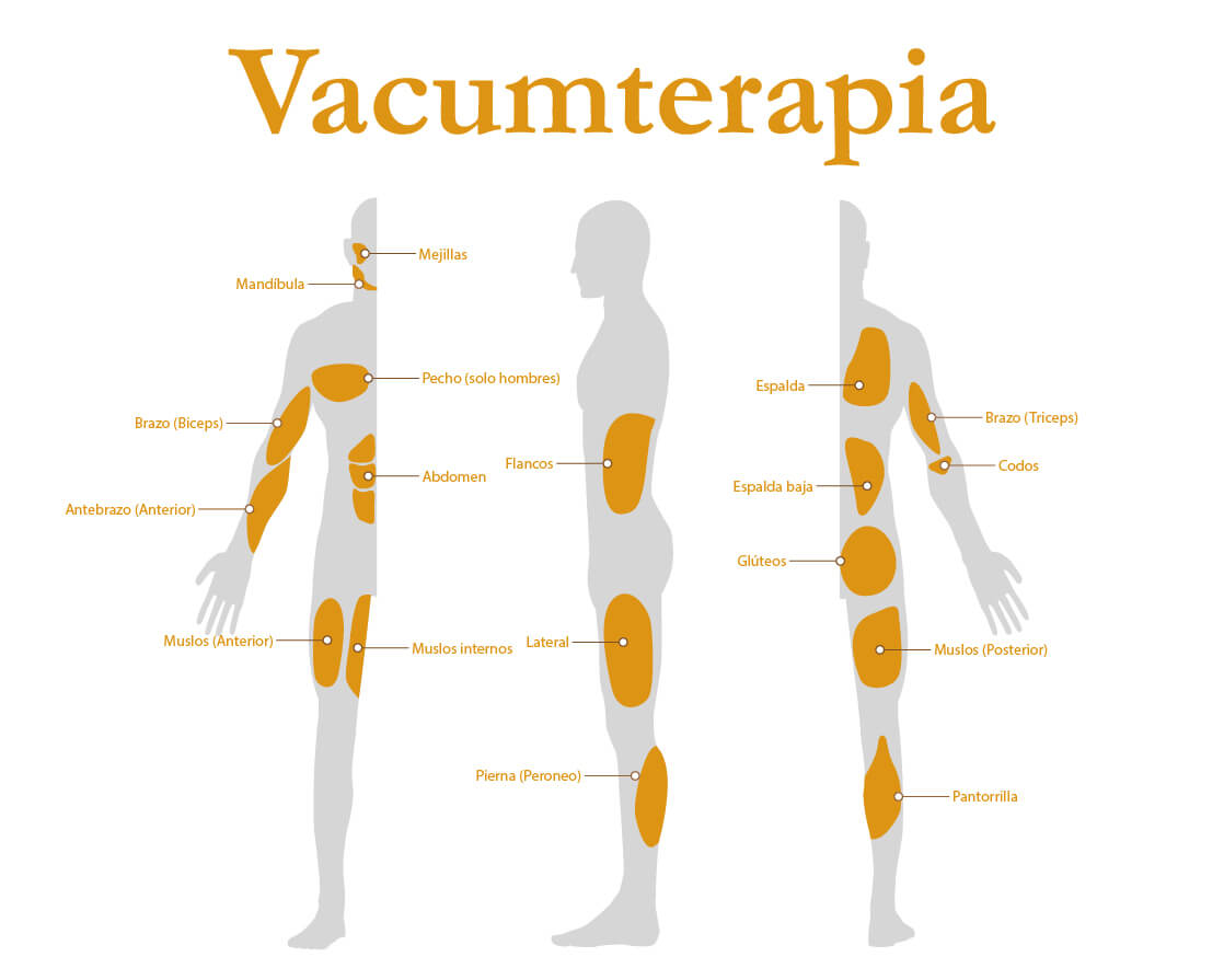 Diagrama Vacumterapia