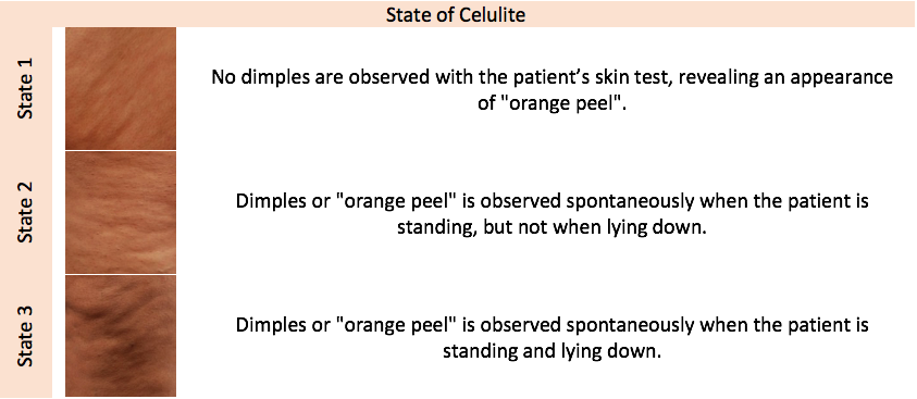 State of celulite